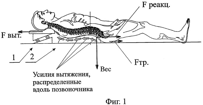 Способ и устройство для коррекции и лечения позвоночника (патент 2389467)