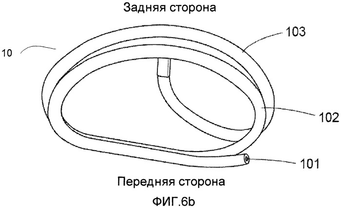 Устройство и способ для уменьшения размера клапана сердца (патент 2491035)