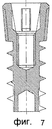 Стоматологический имплантат (патент 2262324)