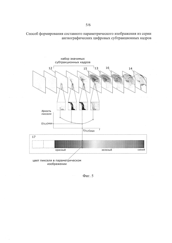 Способ формирования составного параметрического изображения из серии ангиографических цифровых субтракционных кадров (патент 2627270)