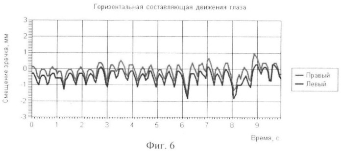 Способ подавления нистагма при движении глаз в различных направлениях (патент 2405406)