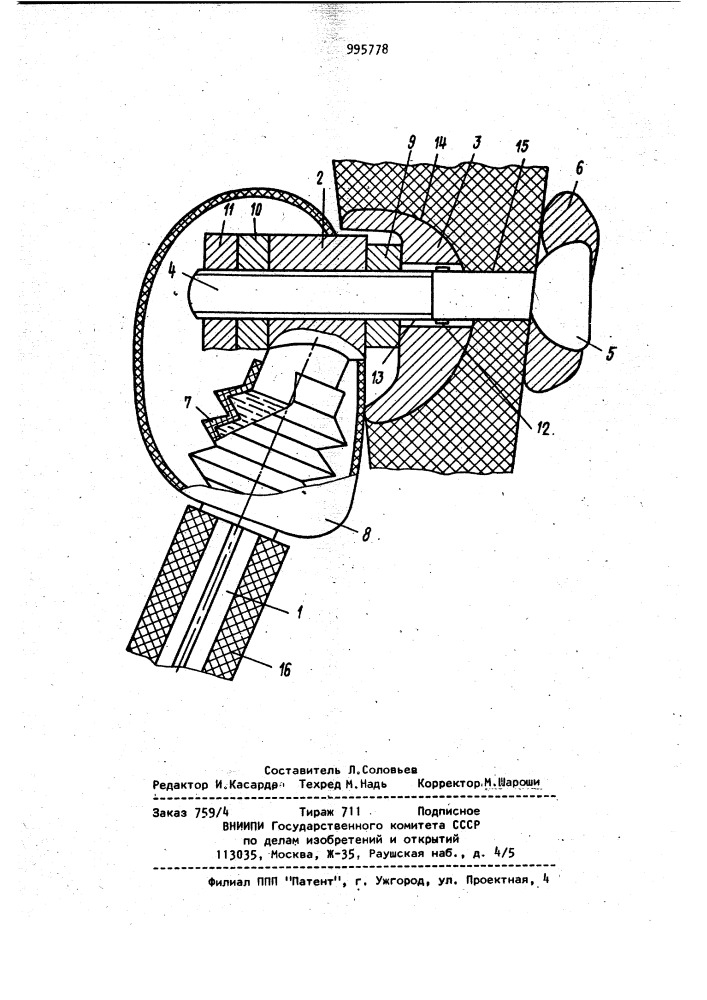 Эндопротез тазобедренного сустава (патент 995778)