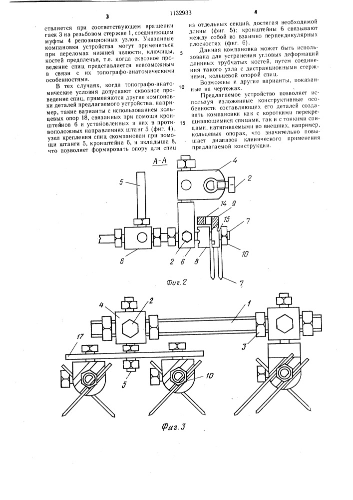 Компрессионно-дистракционное устройство (патент 1132933)