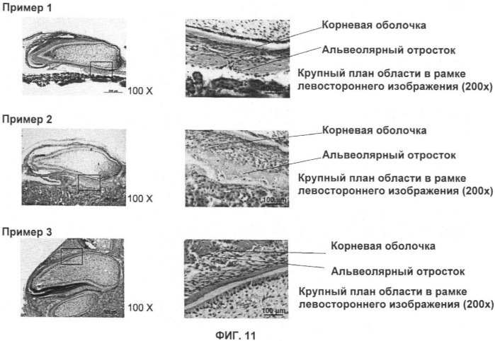 Способ формирования зуба, зубной ряд и способ формирования ткани (патент 2428140)