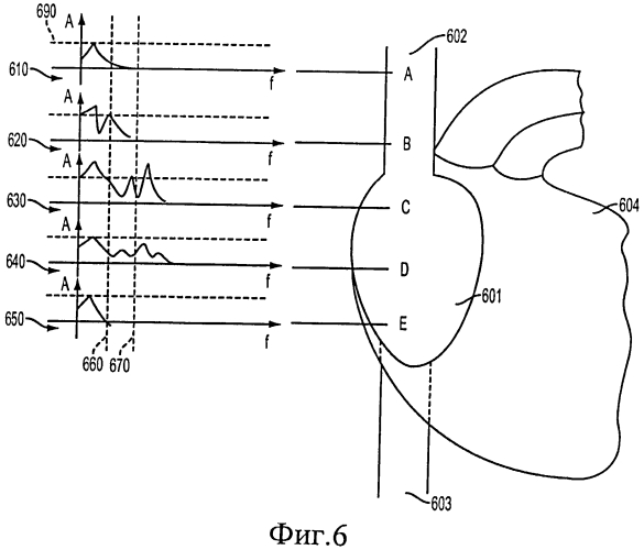 Способ позиционирования конца катетера (патент 2549998)