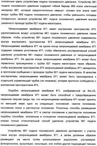 Устройство для лечения путем подкожной подачи пониженного давления с использованием текучей магистрали и связанный с ним способ (патент 2405459)