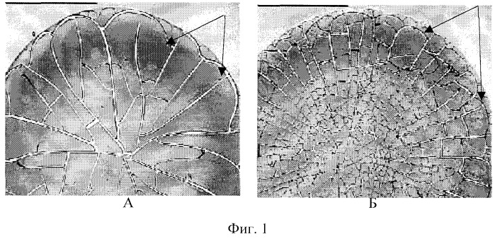 Способ дифференциальной диагностики узловых образований щитовидной железы (патент 2267997)
