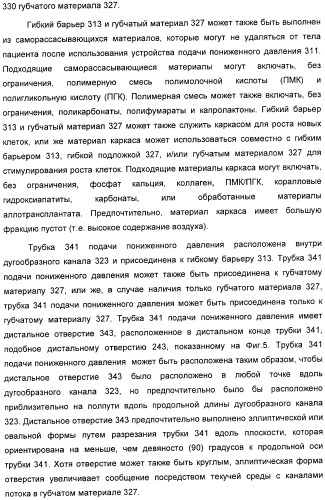 Способ лечения путем подкожной подачи пониженного давления с использованием разделения с помощью воздушного баллона (патент 2405588)