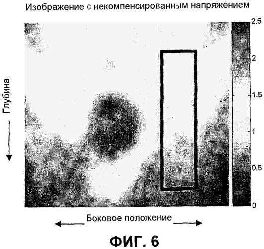 Способ и система компенсации усиления напряжения при создании изображений упругости (патент 2491023)