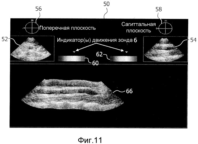Визуализация ультразвуковых изображений с расширенным полем обзора с помощью двумерного матричного зонда (патент 2507535)