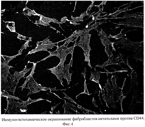 Способ культивирования фибробластов для заместительной терапии (патент 2320720)