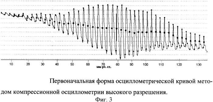 Способ определения артериального давления, параметров гемодинамики и состояния сосудистой стенки с использованием осциллометрии высокого разрешения (патент 2360596)