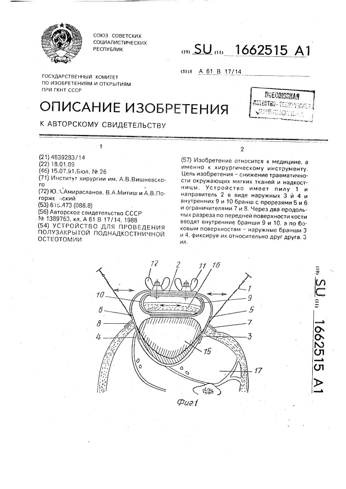 Устройство для проведения полузакрытой поднадкостничной остеотомии (патент 1662515)