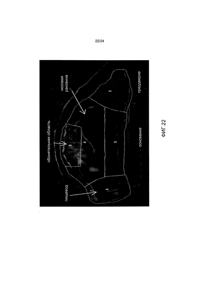 Устройство для назальной доставки лекарственных средств (патент 2612506)