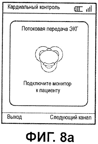 Система контроля экг с конфигурируемыми пределами включения сигналов тревоги (патент 2499550)