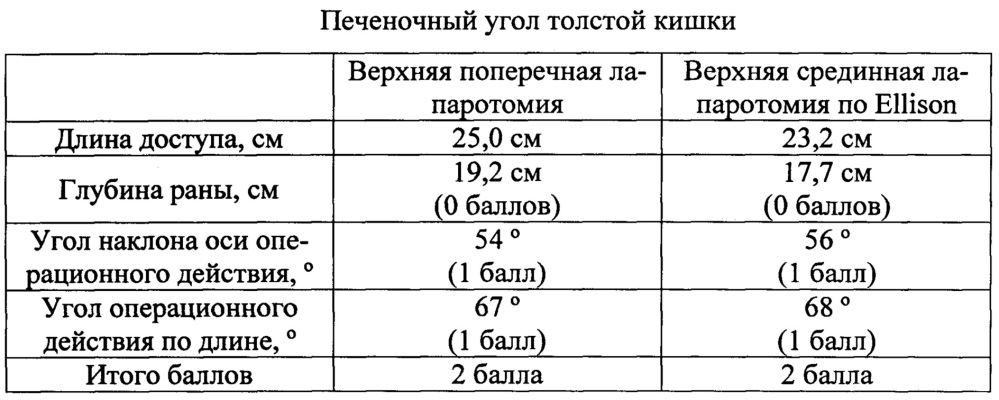 Способ определения оптимального лапаротомного доступа при операциях на поперечно-ободочном отделе толстой кишки (патент 2649571)