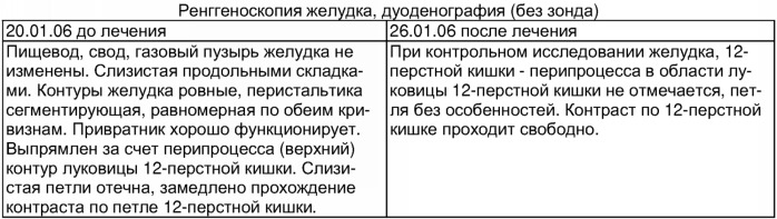 Способ лечения проксимального перидуоденита (патент 2321385)