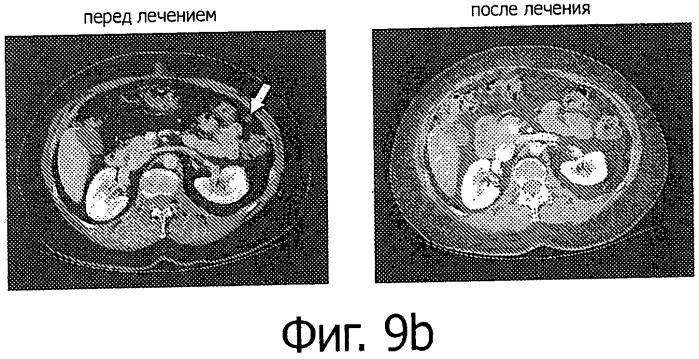 Аденовирусные векторы и способы и применения, связанные с ними (патент 2520823)