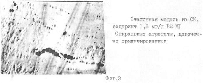 Способ экспресс-диагностики гипер-бета 2-микроглобулинемии (патент 2259565)