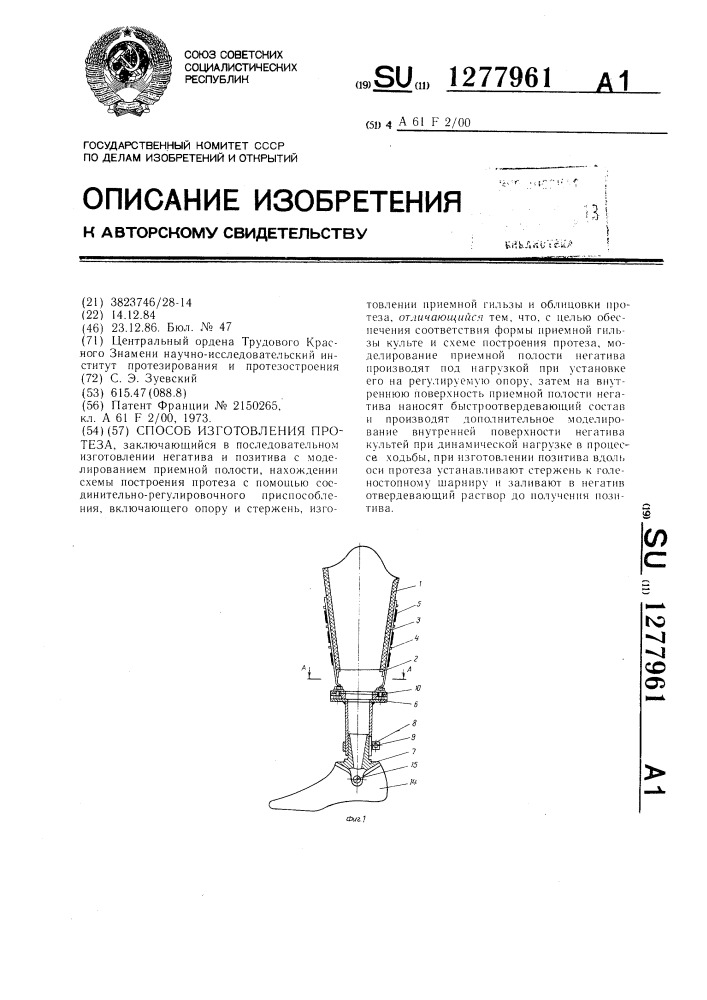 Способ изготовления протеза (патент 1277961)