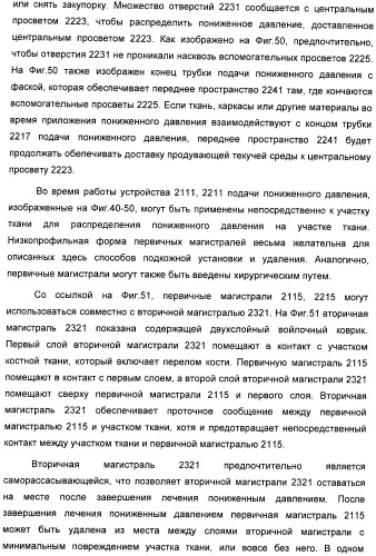 Система и способ продувки устройства пониженного давления во время лечения путем подачи пониженного давления (патент 2404822)