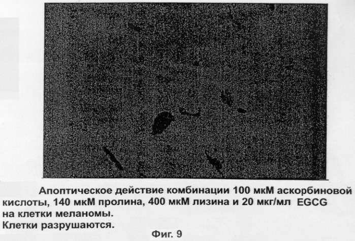 Композиция, ингибирующая матричные металлопротеиназы, предназначенная для лечения неопластических болезней (патент 2284185)