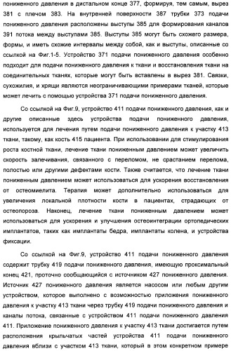 Устройство для лечения путем подкожной подачи пониженного давления с использованием текучей магистрали и связанный с ним способ (патент 2405459)