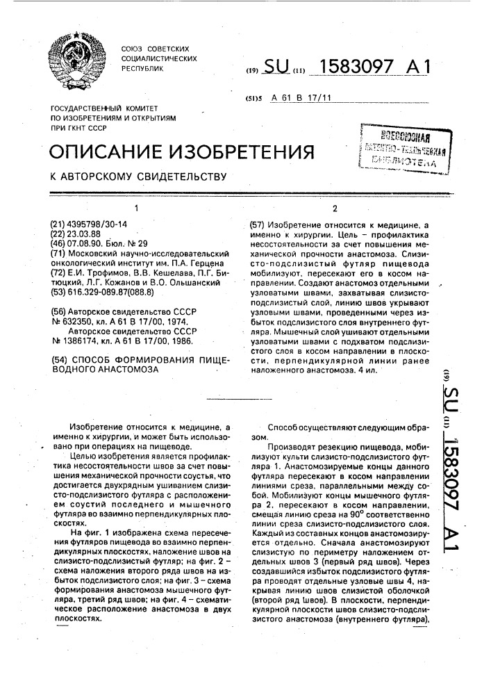 Способ формирования пищевого анастомоза (патент 1583097)