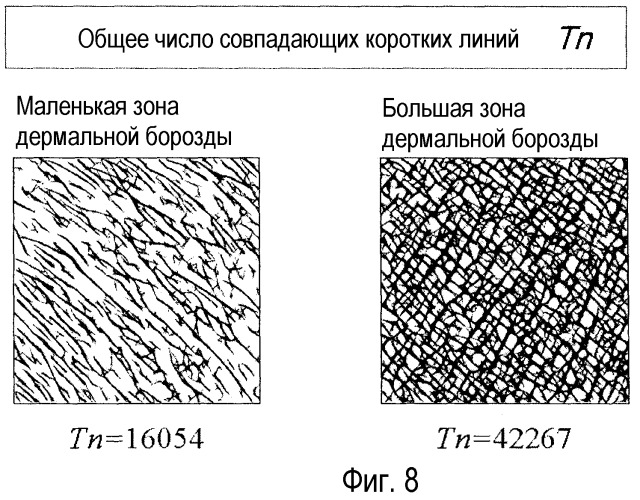 Способ автоматической оценки текстуры кожи и/или морщины (патент 2470576)