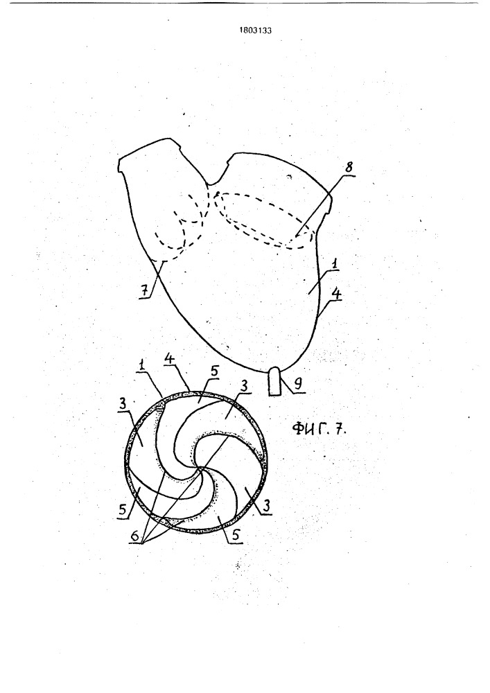Искусственное сердце (патент 1803133)