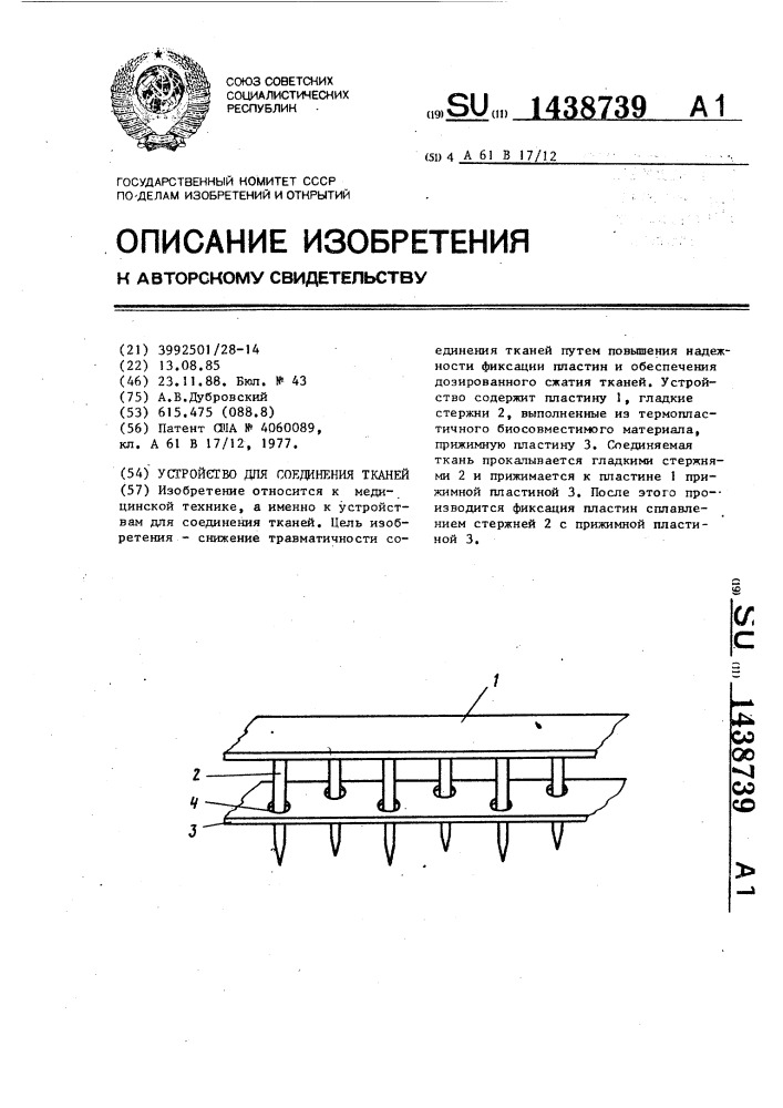 Устройство для соединения тканей (патент 1438739)