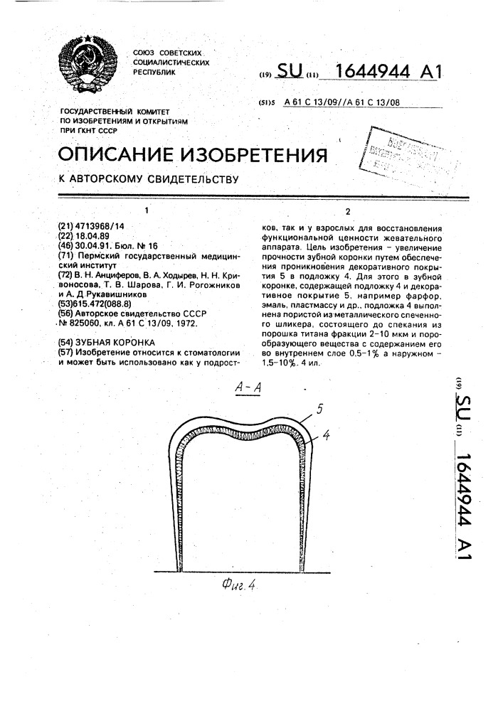 Зубная коронка (патент 1644944)