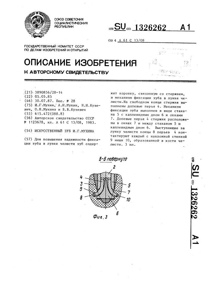 Искусственный зуб и.г.мухина (патент 1326262)