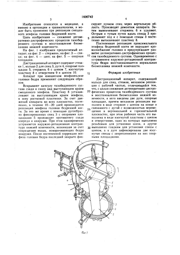 Дистракционный аппарат (патент 1600742)