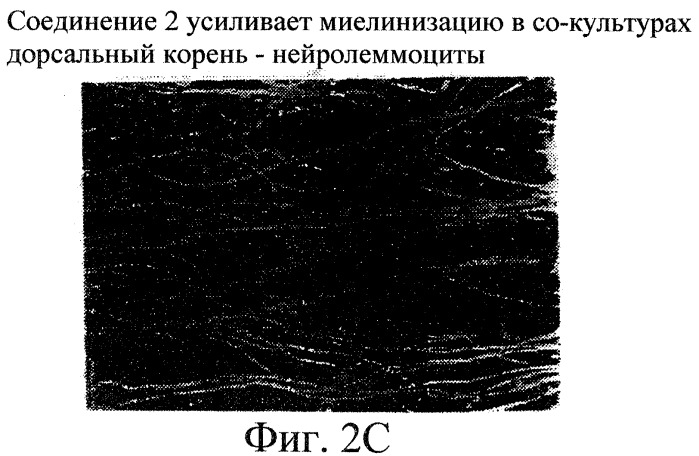Производные пентадикарбоновой кислоты, фармацевтическая композиция на их основе и способы лечения (патент 2268881)