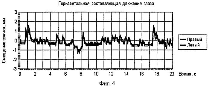 Способ подавления нистагма при движении глаз в различных направлениях (патент 2405406)