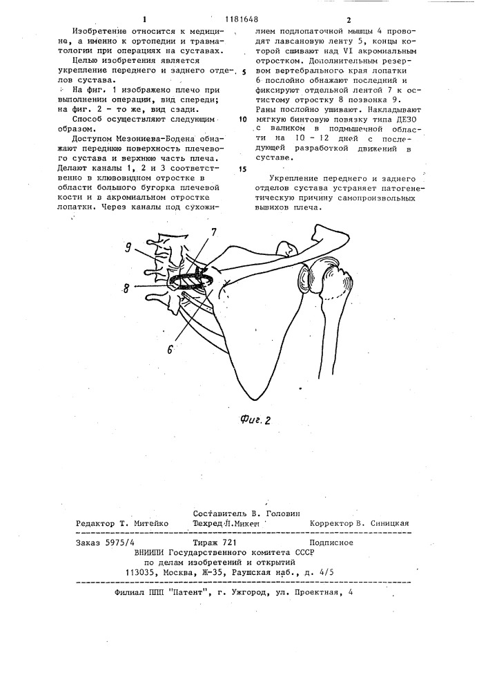 Способ лечения привычного вывиха плеча (патент 1181648)