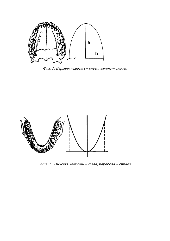 Способ диагностики дефицита места в зубном ряду (патент 2641166)