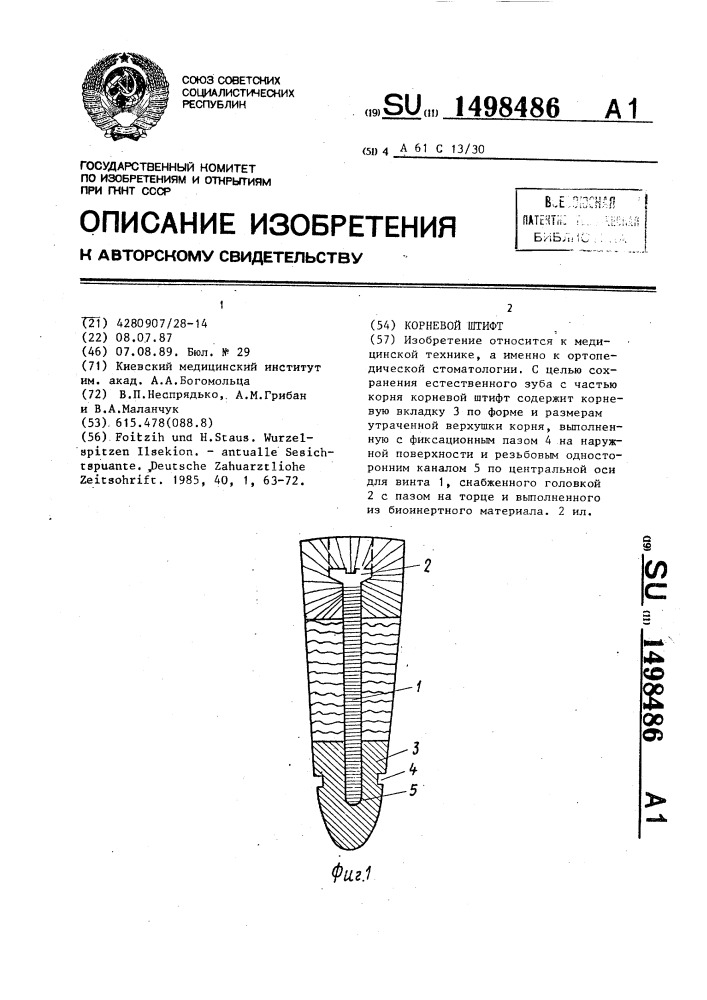 Корневой штифт (патент 1498486)