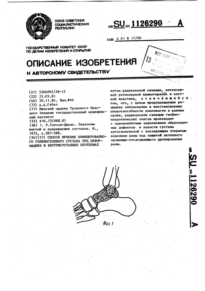 Способ лечения инфицированного голеностопного сустава при деформациях и внутрисуставных переломах (патент 1126290)