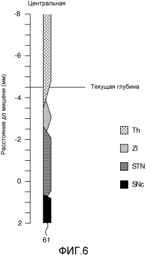 Визуализация хирургических траекторий (патент 2559917)