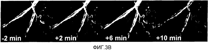 Сенсибилизированный оперативный bold-mri способ получения изображения (патент 2343829)