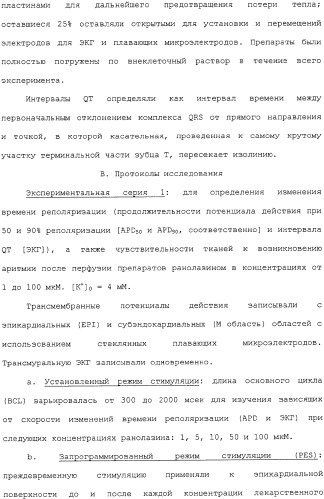 Применение ранолазина для изготовления лекарственного средства для лечения аритмий (патент 2325161)