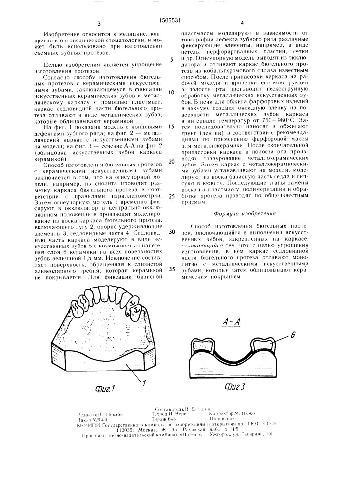 Способ изготовления бюгельных протезов (патент 1505531)