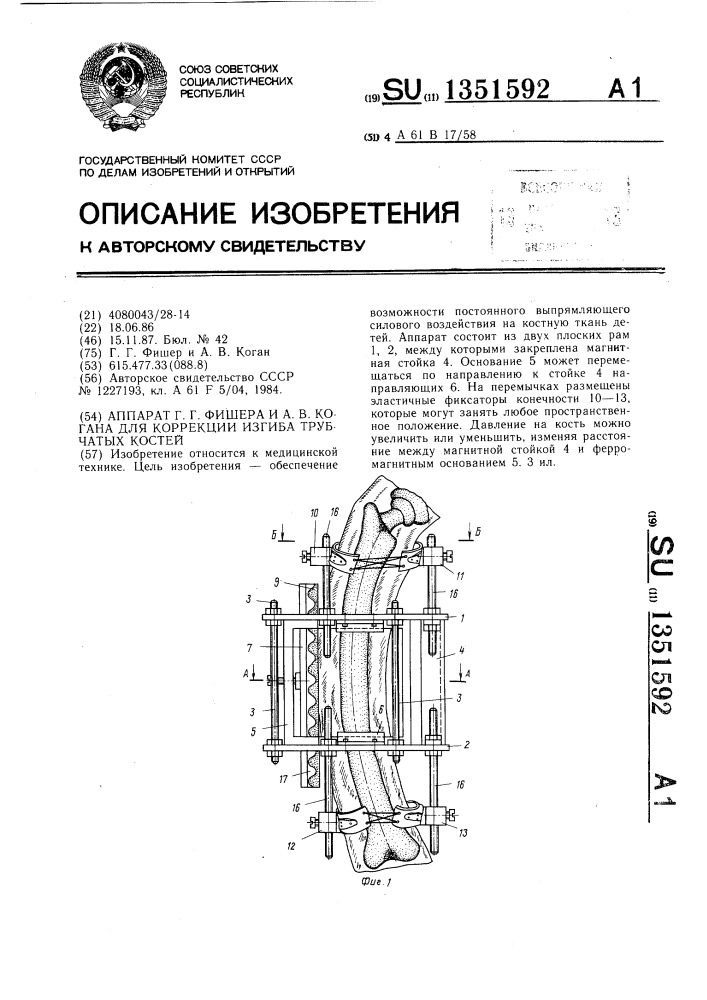 Аппарат г.г.фишера и а.в.когана для коррекции изгиба трубчатых костей (патент 1351592)
