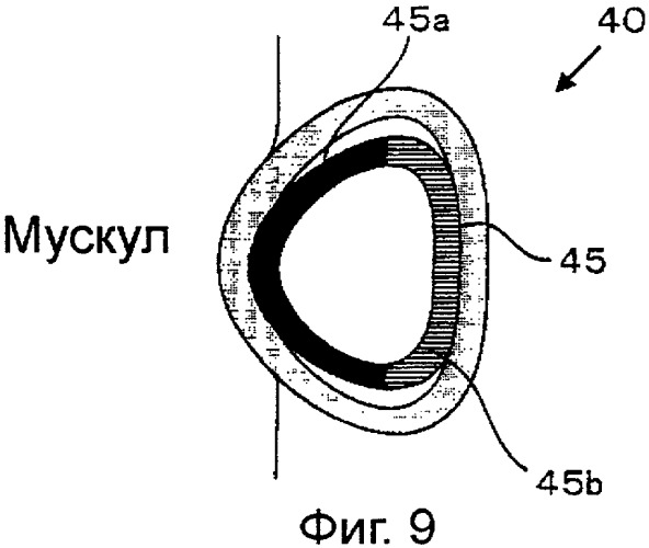 Устройство для укрепления мускулов (патент 2329846)