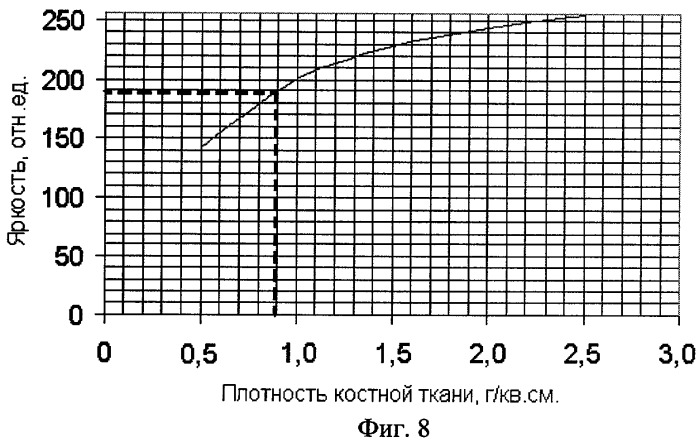 Метод использования рентгеноморфометрии для оценки минеральной плотности костной ткани альвеолярной кости (патент 2320267)