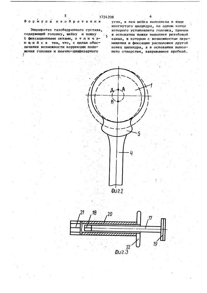 Эндопротез тазобедренного сустава системы д.м.гогуадзе (патент 1724208)