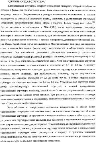 Способы доставки лекарственных средств, структуры и композиции для носослезной системы (патент 2413480)