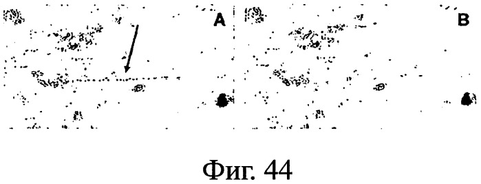 Nanobodies tm для лечения заболеваний, опосредованных агрегацией (патент 2433139)